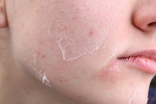 Revitalize Your Skin  The Power of Hyaluronic Acid and Aloe Vera
