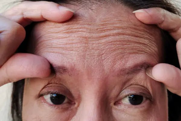 Wrinkles: How They Form and What You Can Do About Them - Vitavelle Cosmetics USA