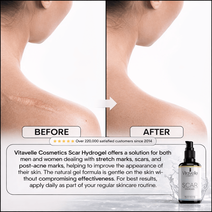 Scar Hydrogel - Vitavelle Cosmetics USA