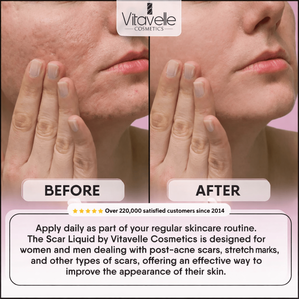 Scar Liquid - Vitavelle Cosmetics USA
