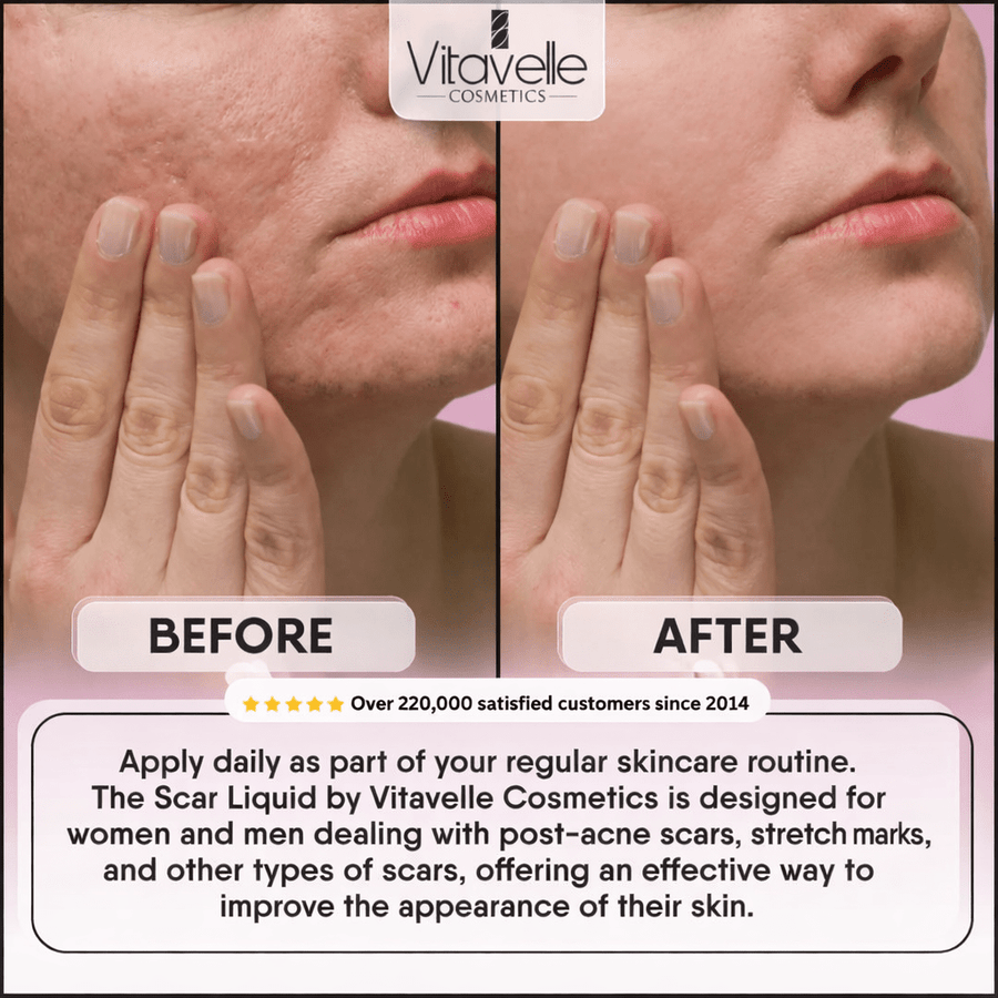 Scar Liquid - Vitavelle Cosmetics USA