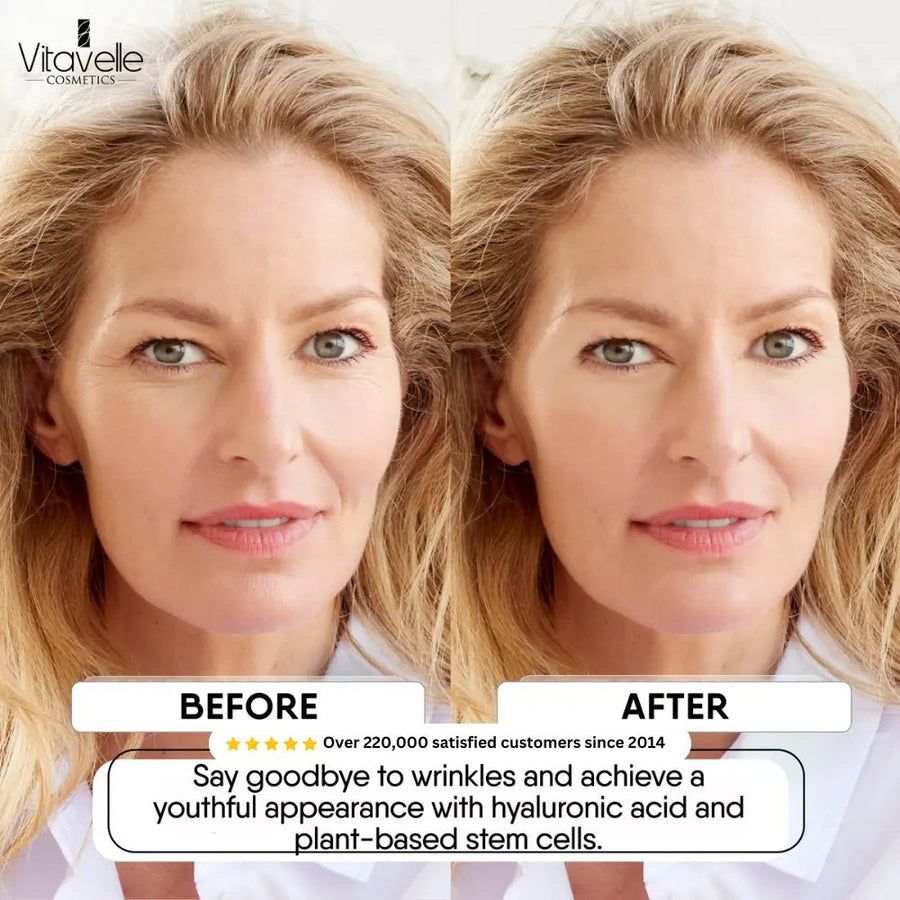 Stem Cell Anti-Aging Cream with Swiss Alpine Rose Stem Cells Stem Cell Anti-Aging Cream with Swiss Alpine Rose Stem Cells